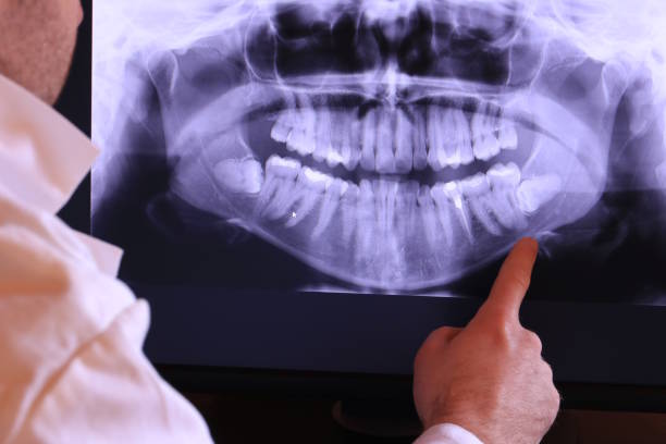 Best Pediatric Emergency Dentist in Westville, IN